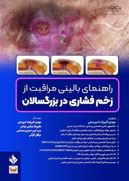 راهنمای بالینی مراقبت از زخم فشاری در بزرگسالان