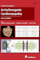 Current Concepts in Arrhythmogenic Cardiomyopathy, Second Edition | مفاهیم فعلی در کاردیومیوپاتی آریتموژنیک، ویرایش دوم