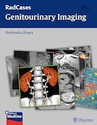 Radcases Genitourinary Imaging | تصویربرداری ادراری تناسلی Radcases