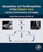Myopathies and Tendinopathies of the Diabetic Foot: Anatomy, Pathomechanics, and Imaging 1st Edition | میوپاتی ها و تانندوپاتی های پای دیابتی: آناتومی، پاتومکانیک، و تصویربرداری ویرایش اول