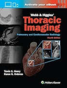 Webb & Higgins Thoracic Imaging | تصویربرداری قفسه سینه وب و هیگینز