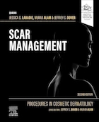 Procedures in Cosmetic Dermatology: Scar Management 2nd Edition | روش های درماتولوژی زیبایی: مدیریت اسکار نسخه دوم