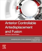 Anterior Controllable Antedisplacement and Fusion: Technique in Spinal Surgery 1st Edition | جابجایی و فیوژن قابل کنترل قدامی: تکنیک در جراحی ستون فقرات ویرایش اول