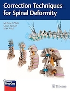 Correction Techniques for Spinal Deformity | تکنیک های اصلاح ناهنجاری ستون فقرات