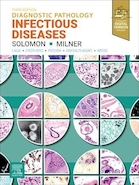 Diagnostic Pathology: Infectious Diseases 3rd Edition | آسیب شناسی تشخیصی: بیماری های عفونی ویرایش سوم