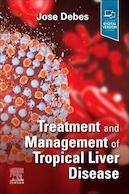 Treatment and Management of Tropical Liver Disease 1st | درمان و مدیریت بیماری گرمسیری کبد ویرایش اول