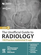 The Unofficial Guide to Radiology: 100 Practice Abdominal X-rays 2nd Edition | راهنمای غیر رسمی رادیولوژی: 100 تمرین با اشعه ایکس شکم ویرایش دوم