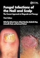 Fungal Infections of the Nail and Scalp: The Current Approach to Diagnosis and Therapy 3rd Edition | عفونت قارچی ناخن و پوست سر: رویکرد کنونی به تشخیص و درمان ویرایش سوم