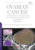 Ovarian Cancer: The 
