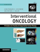 Interventional Oncology: Principles and Practice of Image-Guided Cancer Therapy 2nd Edition | انکولوژی مداخله ای: اصول و عملکرد درمان سرطان با هدایت تصویری ویرایش دوم