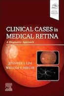 Clinical Cases in Medical Retina: A Diagnostic Approach 1st Edition | موارد بالینی در شبکیه چشم پزشکی: یک رویکرد تشخیصی ویرایش 1