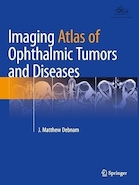 Imaging Atlas of Ophthalmic Tumors and Diseases 2023rd Edition | تصویربرداری اطلس تومورها و بیماری های چشمی نسخه 2023