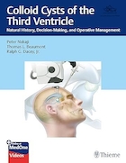 Colloid Cysts of the Third Ventricle: Natural History, Decision-Making, and Operative Management 1st Edition | کیست های کلوئیدی بطن سوم: تاریخچه طبیعی، تصمیم گیری و مدیریت عملیاتی ویرایش اول