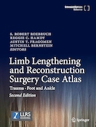 Limb Lengthening and Reconstruction Surgery Case Atlas: Trauma • Foot and Ankle Second Edition | اطلس مورد جراحی افزایش طول و بازسازی اندام: تروما • نسخه دوم پا و مچ پا