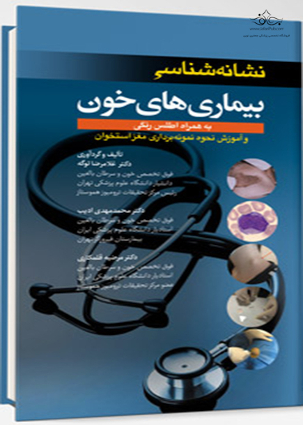 نشانه شناسی بیماری های خونی