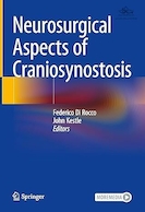 Neurosurgical Aspects of Craniosynostosis | جنبه های جراحی مغز و اعصاب کرانیوسینوستوزیس