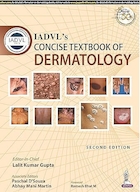 IADVL's Concise Textbook of Dermatology 2nd Edition | IADVL کتاب درسی مختصر درماتولوژی ویرایش دوم