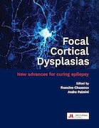 Focal Cortical Dysplasias: New advances for curing epilepsy | دیسپلازی های قشر کانونی: پیشرفت های جدید برای درمان صرع
