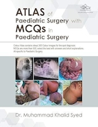 Atlas of Paediatric Surgery with Mcqs in Paediatric Surgery | اطلس جراحی کودکان با Mcqs در جراحی کودکان