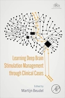 Learning Deep Brain Stimulation Management through Clinical Cases 1st Edition | آموزش مدیریت تحریک عمیق مغز از طریق موارد بالینی ویرایش 1