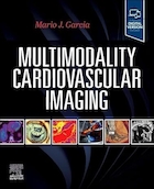 Multimodality Cardiovascular Imaging 1st Edition | نسخه اول تصویربرداری قلبی عروقی چندوجهی