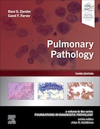 Pulmonary Pathology (Foundations in Diagnostic Pathology) 3rd Edition | پاتولوژی ریوی (مبانی در پاتولوژی تشخیصی) ویرایش سوم
