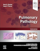 Pulmonary Pathology (Foundations in Diagnostic Pathology) 3rd Edition | پاتولوژی ریوی (مبانی در پاتولوژی تشخیصی) ویرایش سوم
