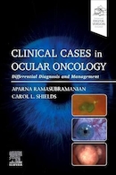 Clinical Cases in Ocular Oncology: Differential Diagnosis and Management 1st Edition | موارد بالینی در انکولوژی چشم: تشخیص افتراقی و مدیریت ویرایش اول