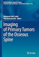 Imaging of Primary Tumors of the Osseous Spine | تصویربرداری از تومورهای اولیه ستون فقرات استخوانی