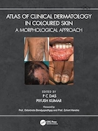 Atlas of Clinical Dermatology in Coloured Skin: A Morphological Approach 1st Edition | اطلس پوست بالینی در پوست رنگی: یک رویکرد مورفولوژیکی ویرایش اول