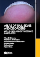 Atlas of Nail Signs and Disorders with Clinical and Onychoscopic Correlation 1st Edition | اطلس علائم و اختلالات ناخن با همبستگی بالینی و اونیکوسکوپی ویرایش اول