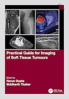 Practical Guide for Imaging of Soft Tissue Tumours 1st Edition | راهنمای عملی برای تصویربرداری از تومورهای بافت نرم ویرایش اول