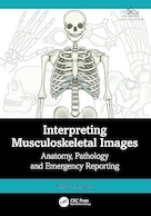 Interpreting Musculoskeletal Images: Anatomy, Pathology and Emergency Reporting 1st Edition | تفسیر تصاویر اسکلتی عضلانی: آناتومی، آسیب شناسی و گزارش اورژانس ویرایش اول