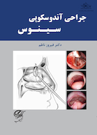جراحی آندوسکوپی سینوس