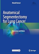 Anatomical Segmentectomy for Lung Cancer: Illustration and Videos | سگمنتکتومی تشریحی برای سرطان ریه: تصویر و فیلم