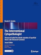 The Interventional Cytopathologist: Ultrasound Guided Fine-Needle Aspiration of Superficial Masses with Ultrasound Correlation | سیتوپاتولوژیست مداخله ای: آسپیراسیون با سوزن ظریف توده های سطحی با هدایت اولتراسوند با همبستگی اولتراسوند