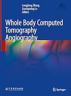 Whole Body Computed Tomography Angiography | آنژیوگرافی توموگرافی کامپیوتری کل بدن