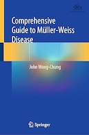 Comprehensive Guide to Müller-Weiss Disease | راهنمای جامع بیماری مولر ویس