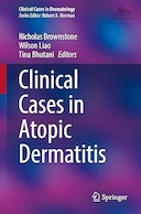 Clinical Cases in Atopic Dermatitis (Clinical Cases in Dermatology) | موارد بالینی درماتیت آتوپیک (موارد بالینی در درماتولوژی)