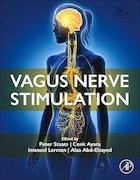 Vagus Nerve Stimulation | تحریک عصب واگ