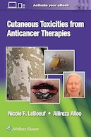 Cutaneous Toxicities from Anticancer Therapies | سموم پوستی ناشی از درمان های ضد سرطان