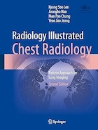 Radiology Illustrated: Chest Radiology: Pattern Approach for Lung Imaging Second Edition | رادیولوژی مصور: رادیولوژی قفسه سینه: رویکرد الگو برای تصویربرداری ریه ویرایش دوم