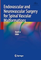 Endovascular and Neurovascular Surgery for Spinal Vascular Malformations | جراحی اندوواسکولار و عصبی برای ناهنجاری های عروقی ستون فقرات