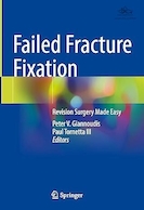 Failed Fracture Fixation: Revision Surgery Made Easy | رفع شکستگی ناموفق: جراحی تجدید نظر آسان شد
