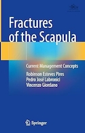 Fractures of the Scapula: Current Management Concepts | شکستگی های کتف: مفاهیم مدیریت فعلی