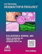 Ace The Boards: Dermatopathology | تخته آس: آسیب شناسی پوست