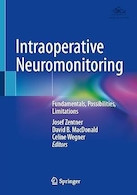 Intraoperative Neuromonitoring: Fundamentals, Possibilities, Limitations | مانیتورینگ عصبی حین عمل: مبانی، امکانات، محدودیت ها