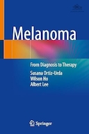 Melanoma: From Diagnosis to Therapy | ملانوما: از تشخیص تا درمان