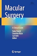 Macular Surgery: A Clinical Guide | جراحی ماکولا: راهنمای بالینی