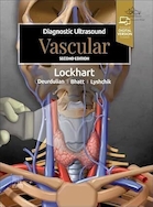Diagnostic Ultrasound: Vascular 2nd Edition | سونوگرافی تشخیصی: نسخه دوم عروق